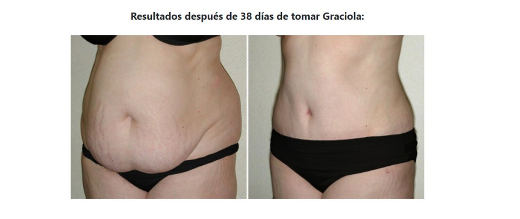 Como preparar Graciola