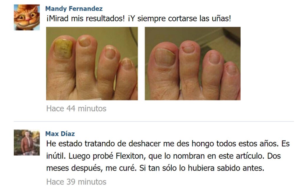 Flexiton lineus testimonios